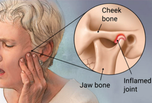 TMJ-pain